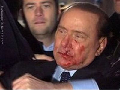 The Truth About Attack on Berlusconi (5 pics)