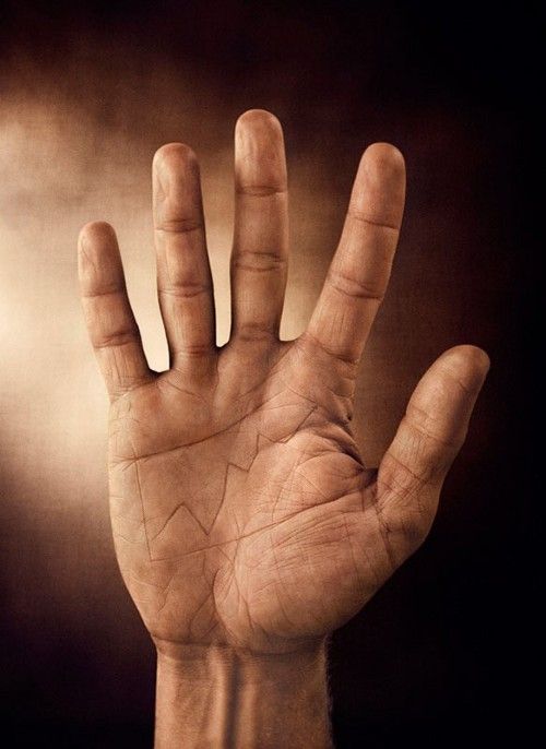 Acid Picdump (100 pics)