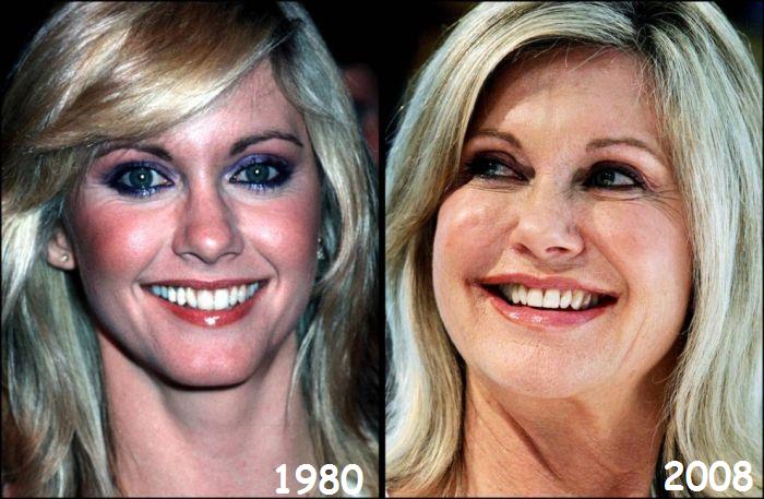 Celebrities. Then and Now (28 pics)