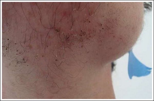 Lighter Shave (20 pics)