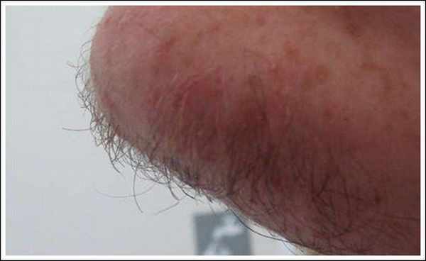 Lighter Shave (20 pics)