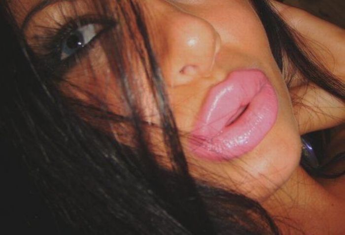 Girl with Fake Lips (19 pics)