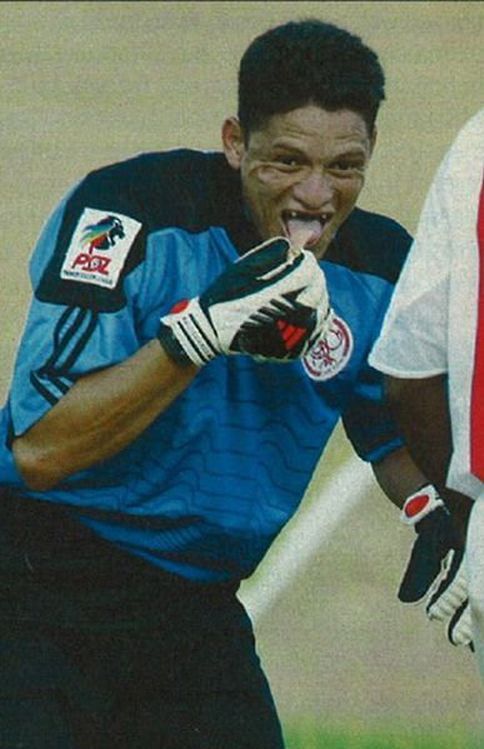 A Goalkeeper Lost His Teeth During a Game (5 pics)