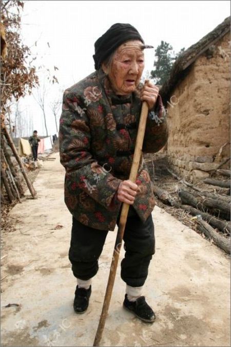 Chinese Woman with a Horn on Her Head (9 pics)