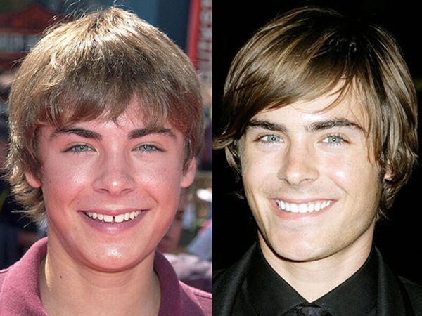 Famous Smiles. Before and After (10 pics)