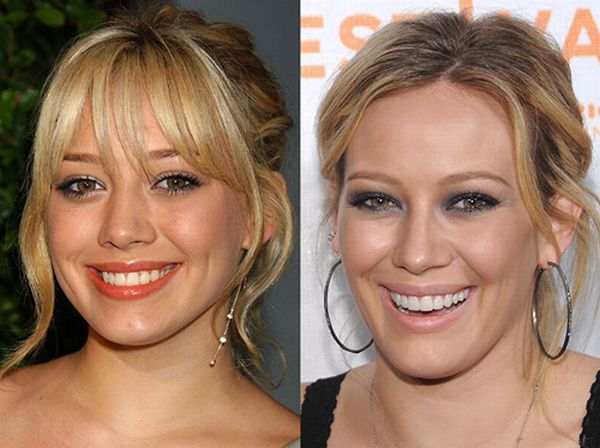 Famous Smiles. Before and After (10 pics)