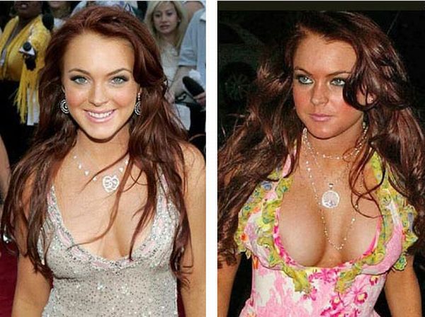 Celebrities Before and After Boob Jobs (15 pics)