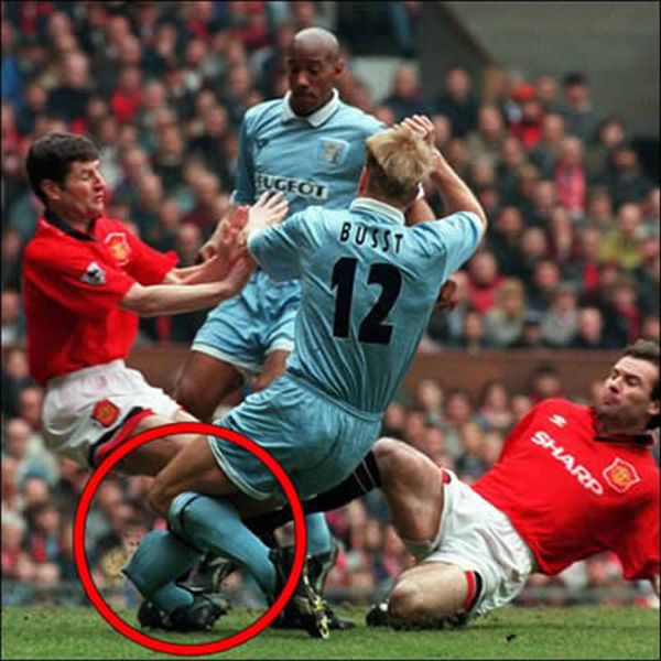 Worst Soccer Injuries (15 pics)