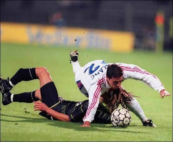 Worst Soccer Injuries 15 Pics