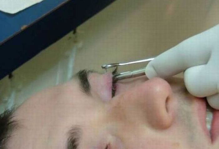 Eye Piercing (18 pics)