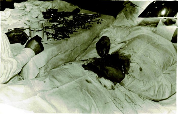 The Story of Dr Leonid Rogozov (4 pics)