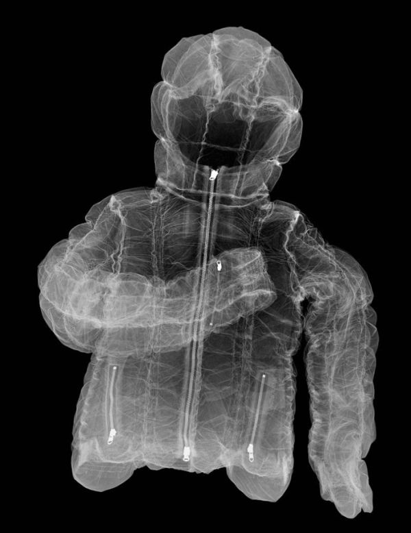 X-Ray Pictures (15 pics)