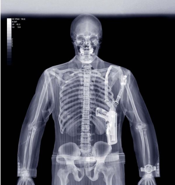 X-Ray Pictures (15 pics)