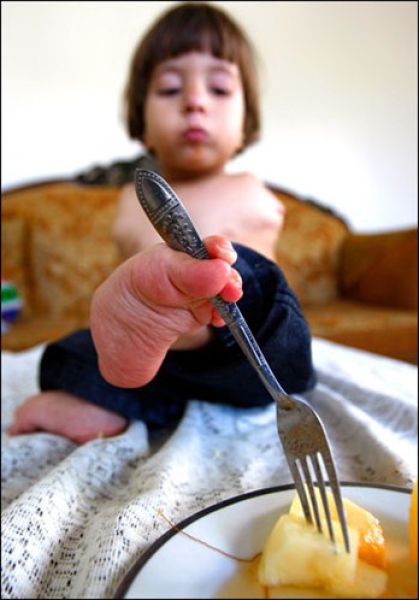 Ali Srour, Boy Who Uses Feet Instead of Hands (14 pics)