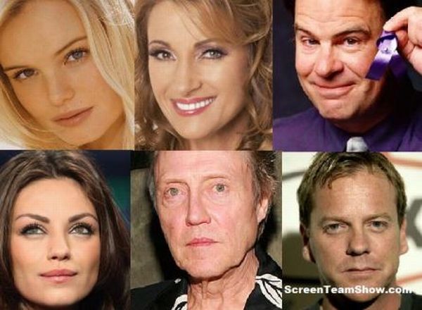 Celebrities with Deformities  (17 pics)