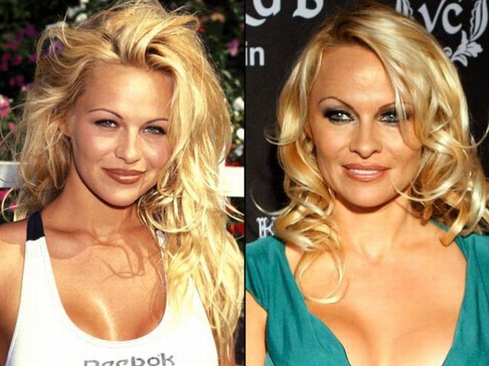 Celebrities Before and After a Plastic Surgery (21 pics)