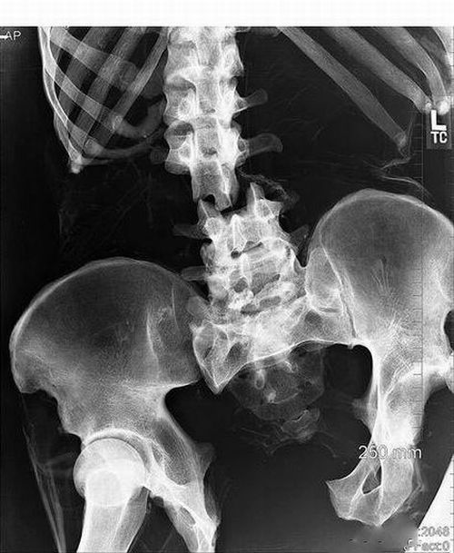The Weirdest X-Rays Ever (20 pics)