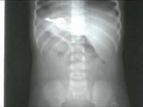 The Weirdest X-Rays Ever (20 pics)