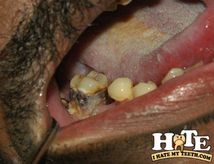 The Worst Teeth Ever (31 pics)