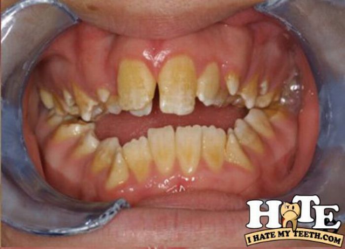 The Worst Teeth Ever (31 pics)