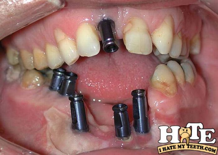 The Worst Teeth Ever (31 pics)