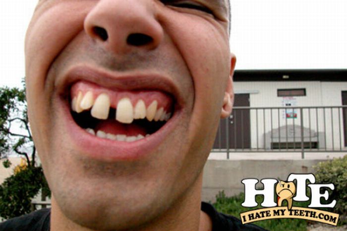 The Worst Teeth Ever (31 pics)