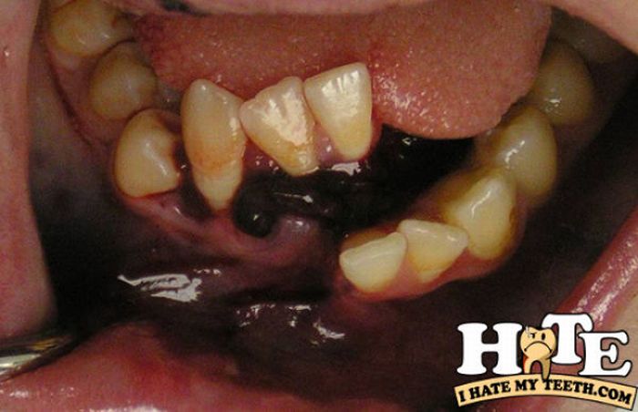 The Worst Teeth Ever (31 pics)