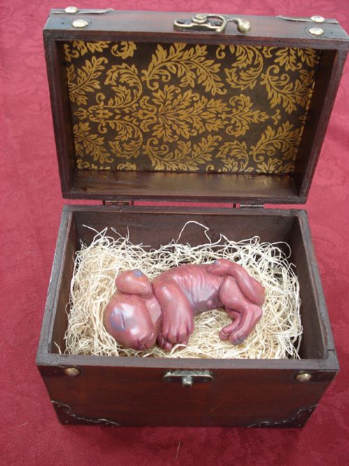 Bizarre Chimera Fetus (9 pics)