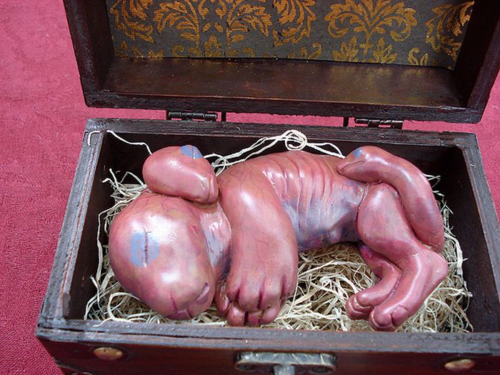 Bizarre Chimera Fetus (9 pics)