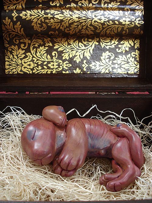 Bizarre Chimera Fetus (9 pics)