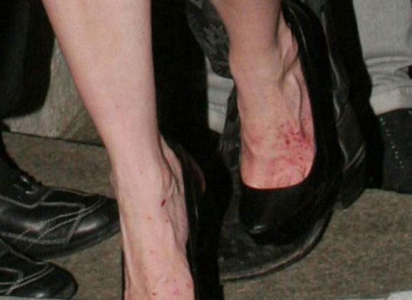 Celebrities With Ugly Feet (21 pics) .