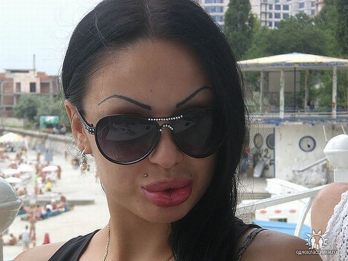 Girls With Silicone Lips. Part 2 (40 pics)