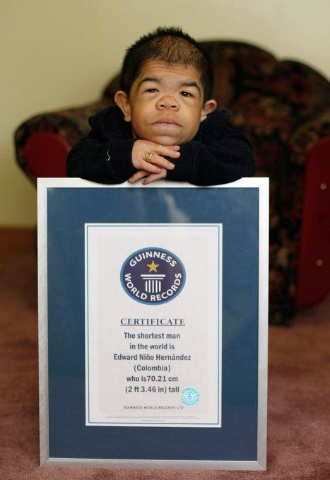World's Shortest Man (11 pics + video)