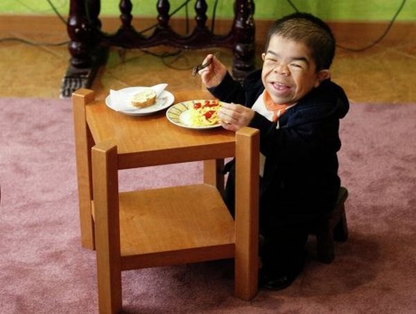 World's Shortest Man (11 pics + video)
