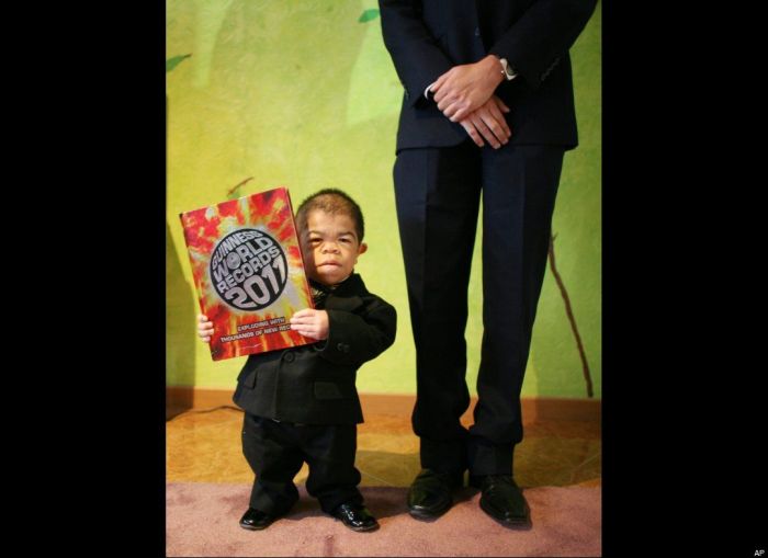 World's Shortest Man (11 pics + video)