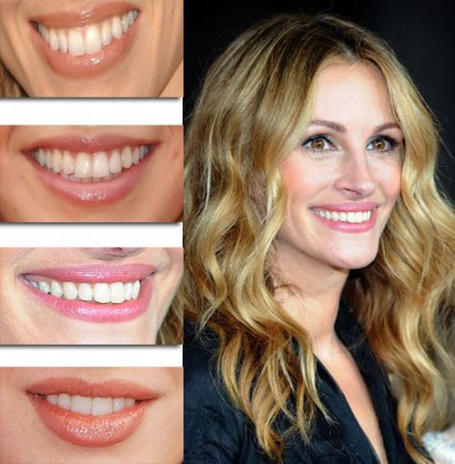 Guess the Celebrity Smile (20 pics)