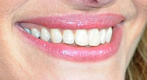 Guess the Celebrity Smile (20 pics)