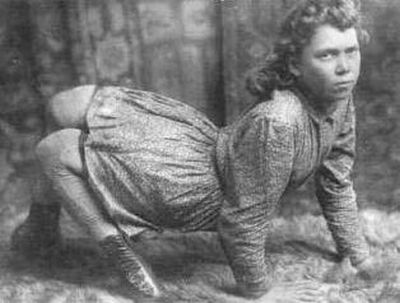 Circus Freaks of the Past (25 pics)