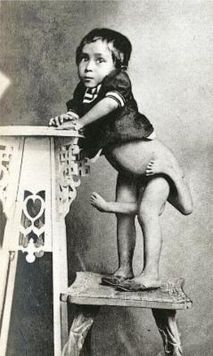 Circus Freaks of the Past (25 pics)