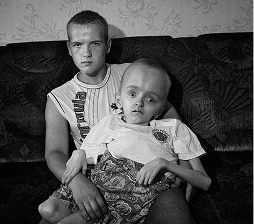 Chernobyl Legacy by Paul Fusco (15 pics)
