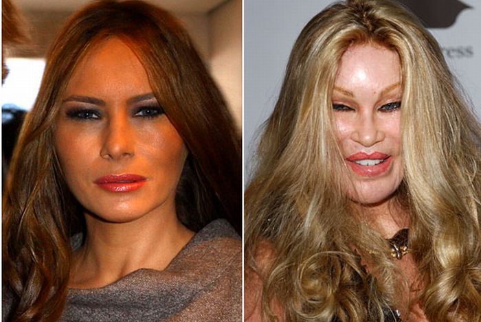 The Official Carla Bruni Facelift Timeline (15 pics)