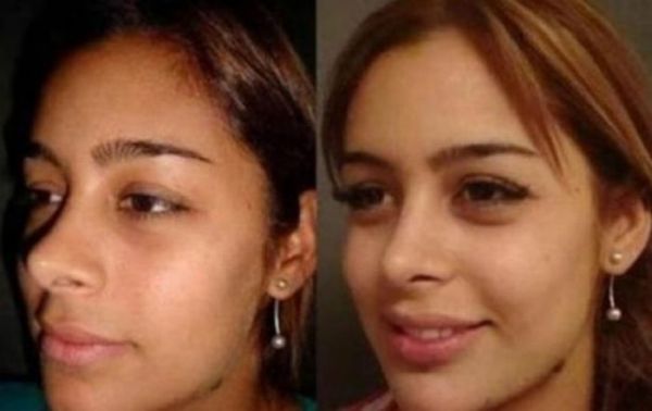 Larissa Riquelme Before and After Plastic Surgeries (9 pics)