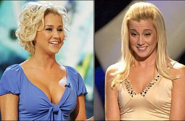 Celebrities Before And After Breast Enlargement 10 Pics