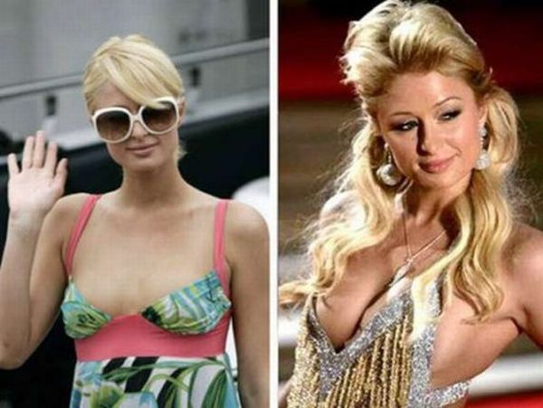 Celebrities Before and After Breast Enlargement (10 pics)