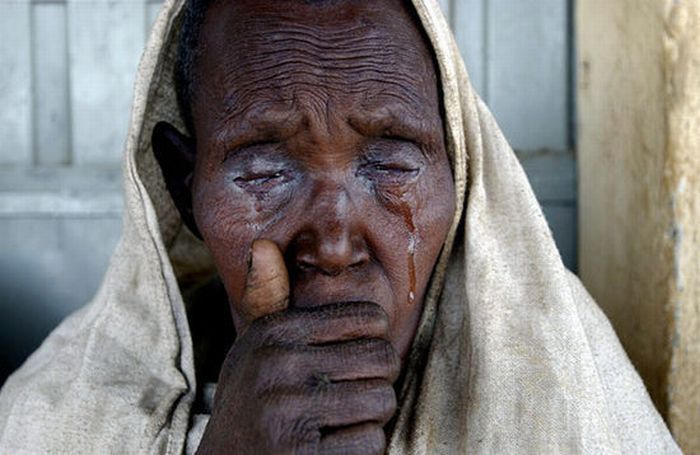 Faces of Poverty (33 pics)