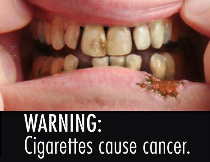 U.S.Cigarette Product Warning Labels (36 pics)