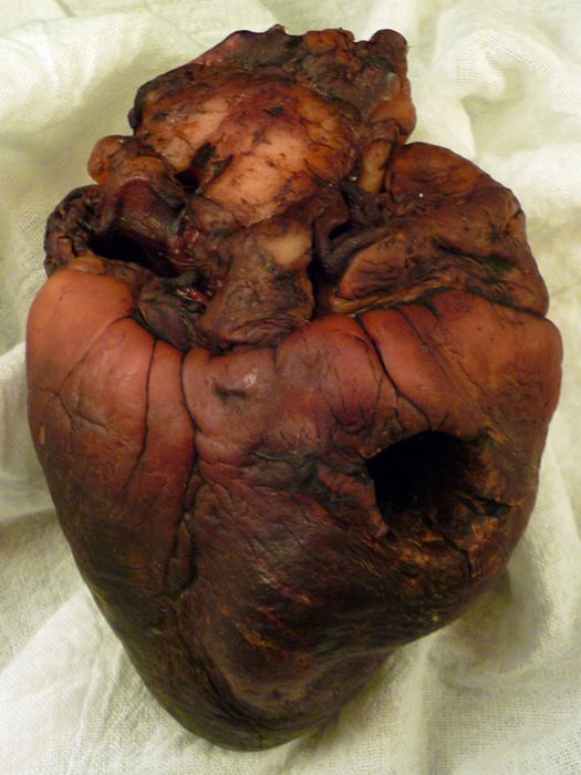 Mummified Vampire Heart is for Sale on Ebay (7 pics)