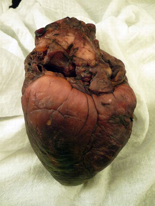 Mummified Vampire Heart is for Sale on Ebay (7 pics)