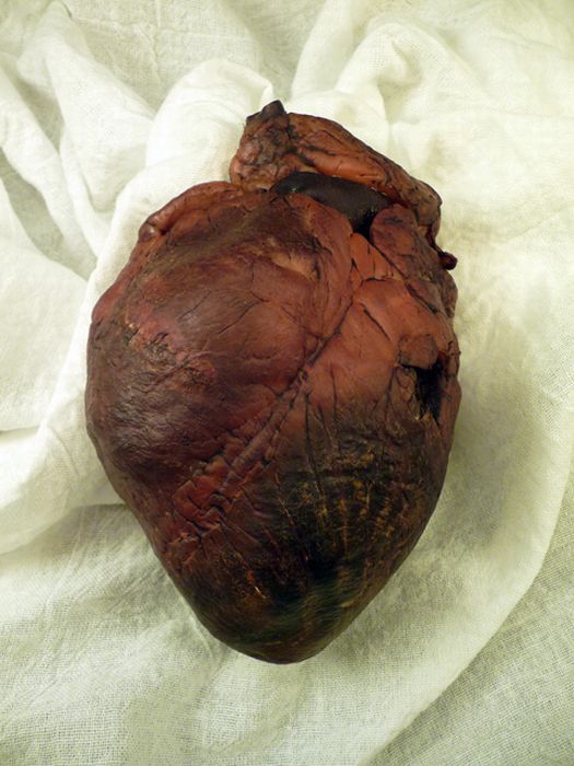 Mummified Vampire Heart is for Sale on Ebay (7 pics)