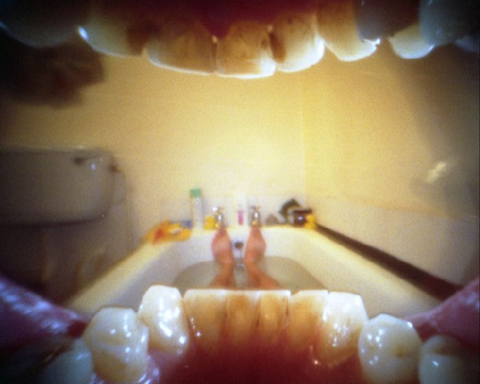 Acid Picdump (100 pics)